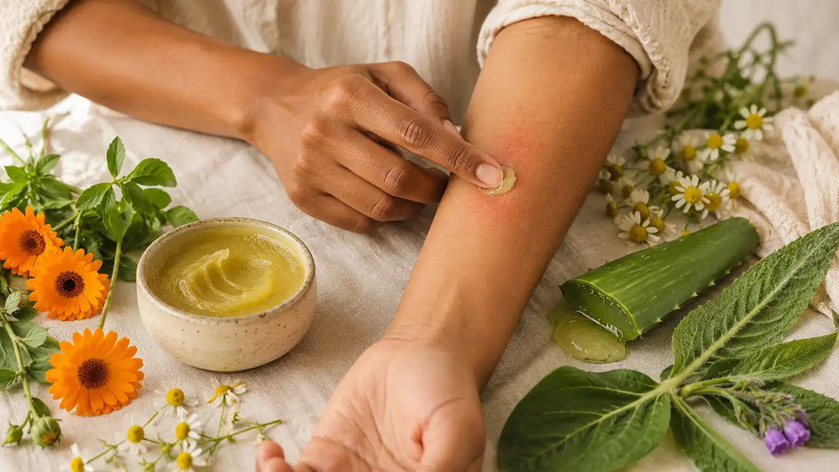 Herbs for skin rash that calm itch, redness and sting